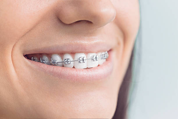 Best Veneers and Lumineers  in Edgerton, WI